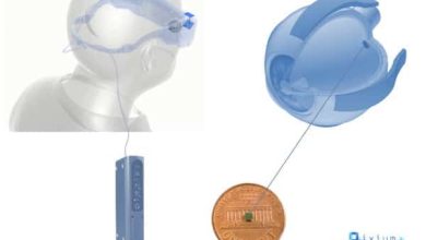 Sistema de visi&oacute;n bi&oacute;nica