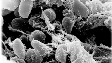 peste bub&oacute;nica