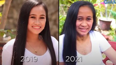 Tiene 16 a&ntilde;os y aparenta 50