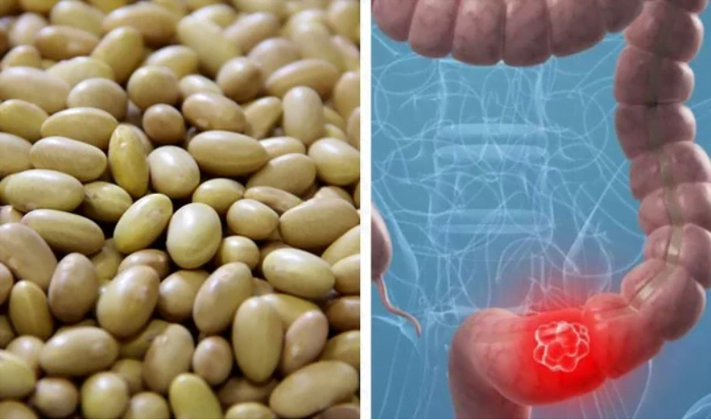 prevenir el c&aacute;ncer de colon