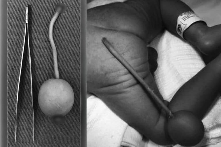 beb&eacute; con una cola humana 