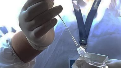 reporte de contagios y muertes