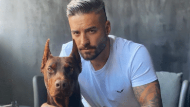 Maluma mostr&oacute; como le qued&oacute; su rostro tras ser mordido por su perro