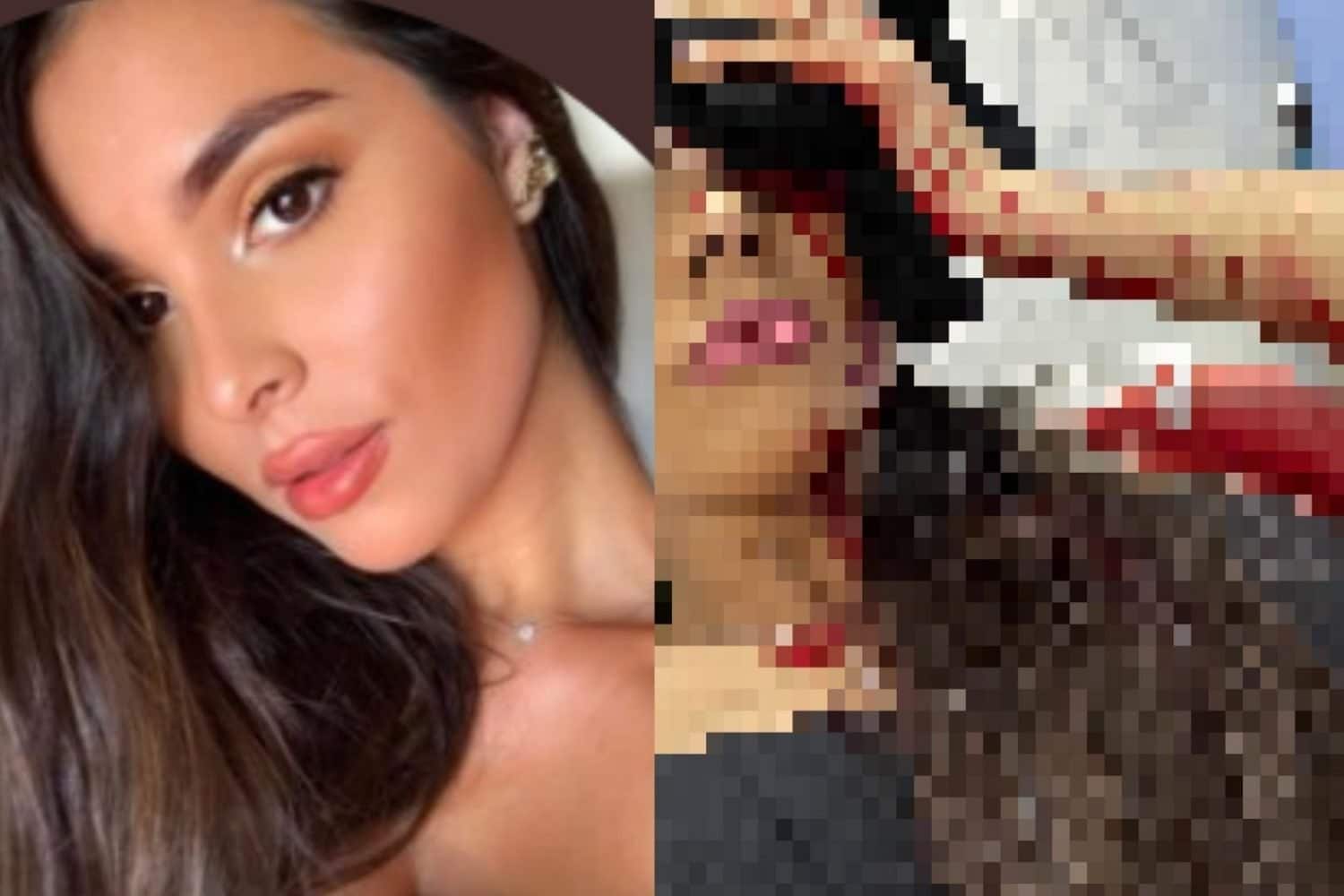 joven ataca en discoteca