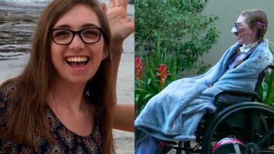 Una mujer fue mordida 800 veces por dos perros