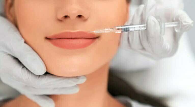 botox y el &aacute;cido hialur&oacute;nico