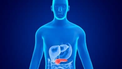 4 principales s&iacute;ntomas del c&aacute;ncer de p&aacute;ncreas que mucha gente ignora