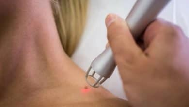 c&aacute;ncer de piel