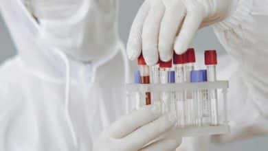 viruela del mono en bogot&aacute;