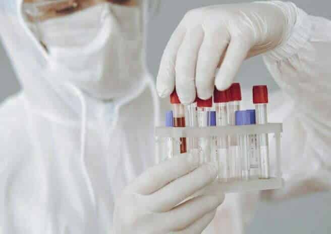 viruela del mono en bogot&aacute;