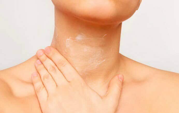 arrugas en el cuello