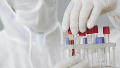 s&iacute;ntomas de la viruela del mono / primer fallecido por viruela del mono en India