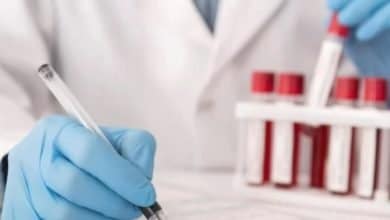 viruela del mono en Colombia / viruela del mono en el pa&iacute;s / viruela del mono