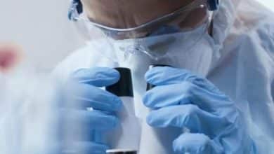 viruela del mono en chile