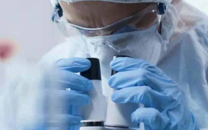 viruela del mono en chile