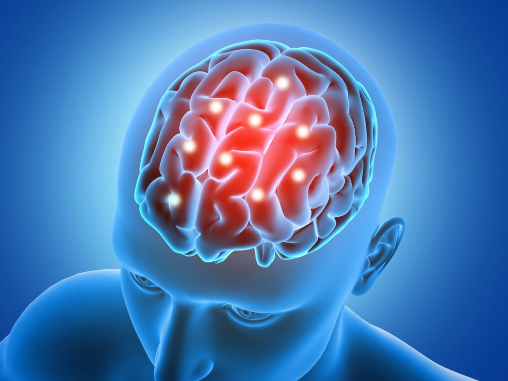 accidente cerebrovascular / c&aacute;ncer cerebral / memoria selectiva