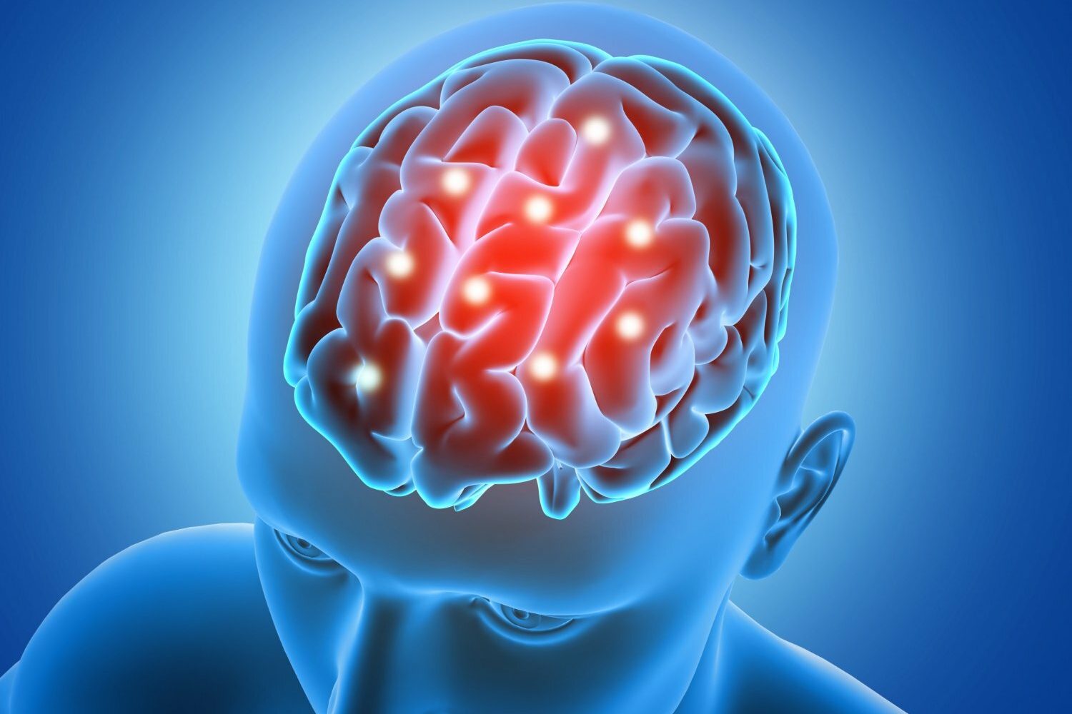 accidente cerebrovascular / c&aacute;ncer cerebral / memoria selectiva