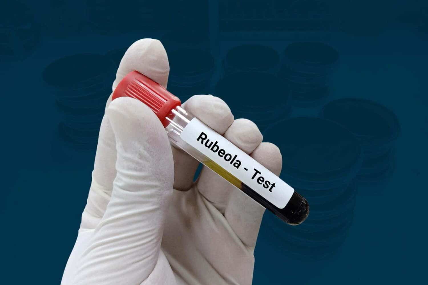 rub&eacute;ola en Bolivia