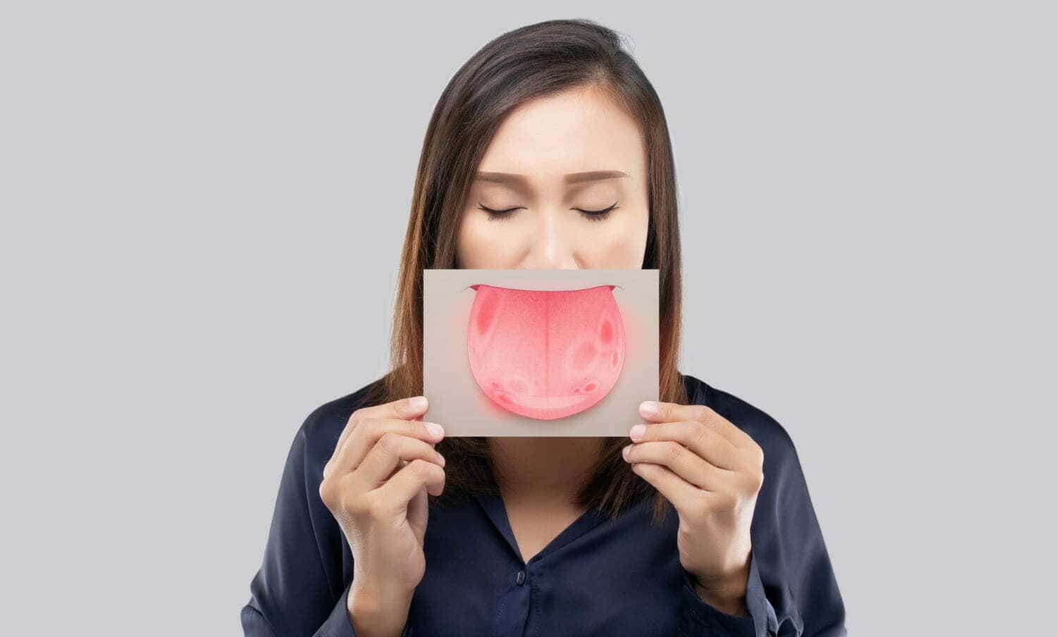 C&aacute;ncer de lengua