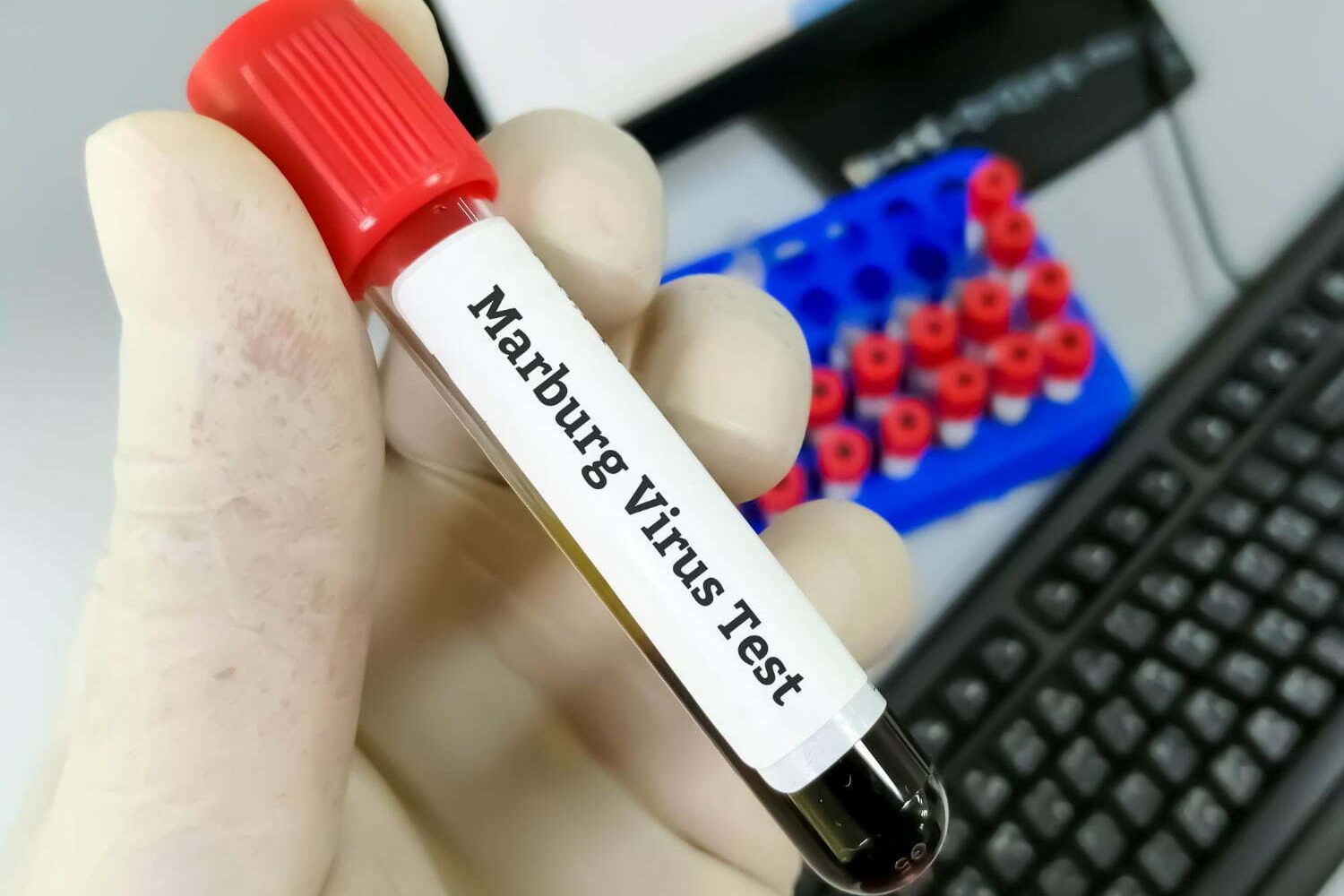 virus de Marburgo / virus de Marburgo en Ghana