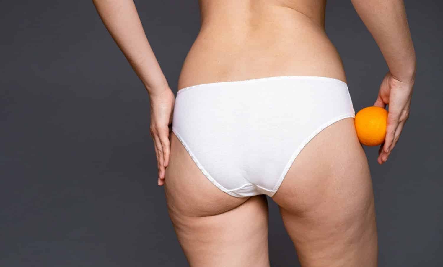 La celulitis alimentos