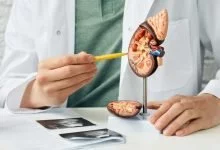 Síntomas del cáncer de riñón, su diagnóstico y tratamiento