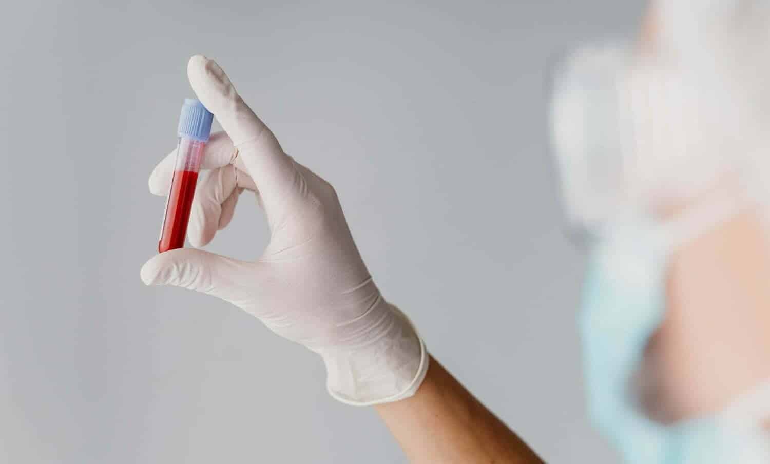 limpiar la sangre - tipo de sangre