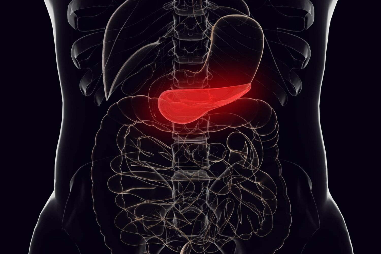 relaci&oacute;n entre el c&aacute;ncer de p&aacute;ncreas y el consumo de az&uacute;car