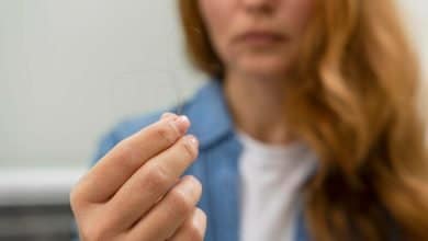 ca&iacute;da del pelo