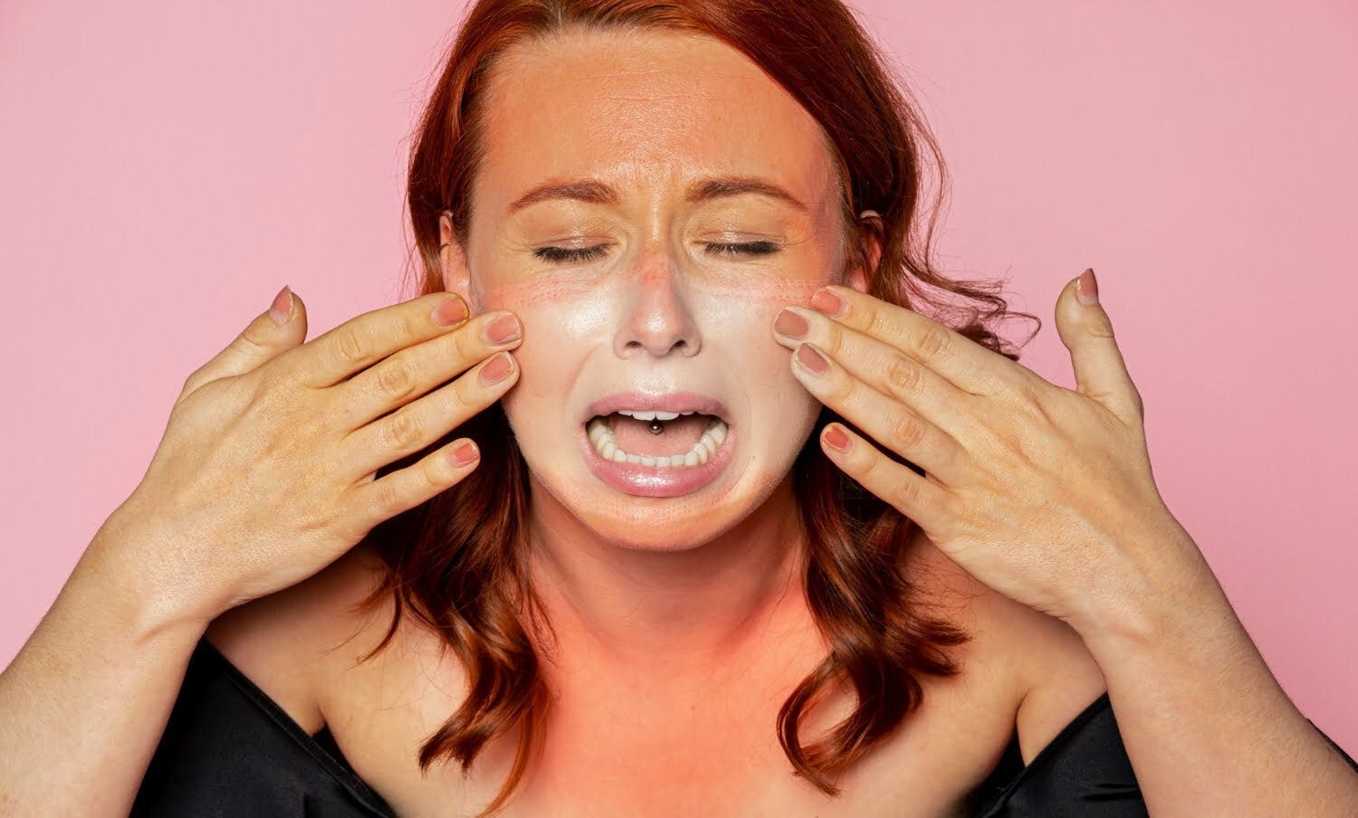 quemaduras solares / bicarbonato