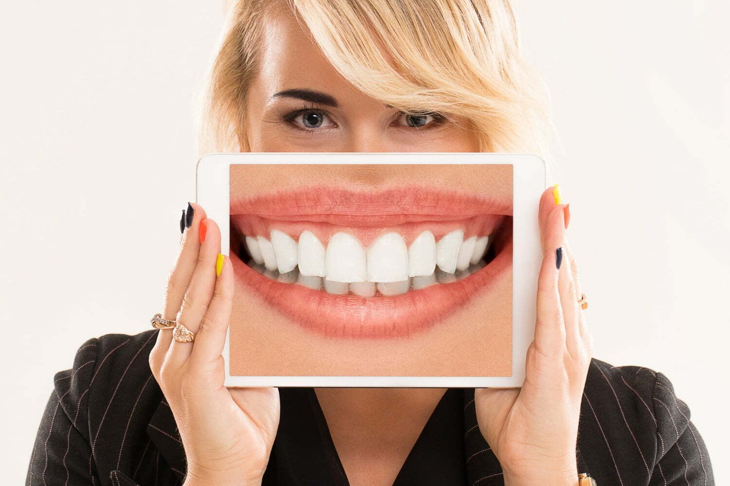 alimentos que manchan los dientes