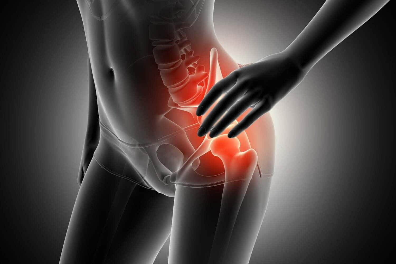 3d render de una figura femenina cogiendo la cadera en dolor con el esqueleto destacado