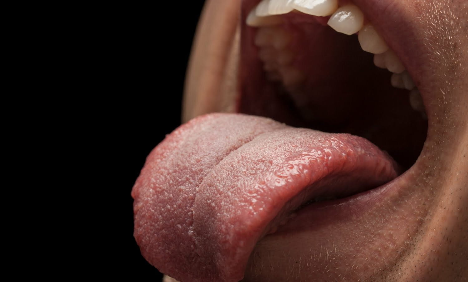 Dientes y lengua de una persona / apariencia de la lengua