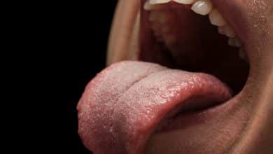 Dientes y lengua de una persona / apariencia de la lengua