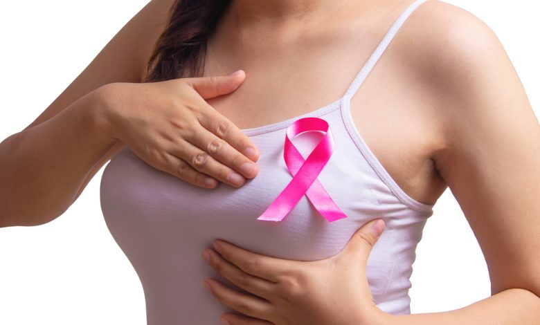 Quiénes son las mujeres con muy alto riesgo de cáncer de mama