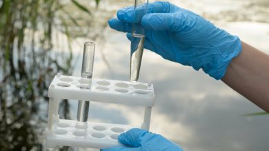 Tomar una prueba de agua para el an&aacute;lisis de un dep&oacute;sito / c&oacute;lera en Rep&uacute;blica Dominicana