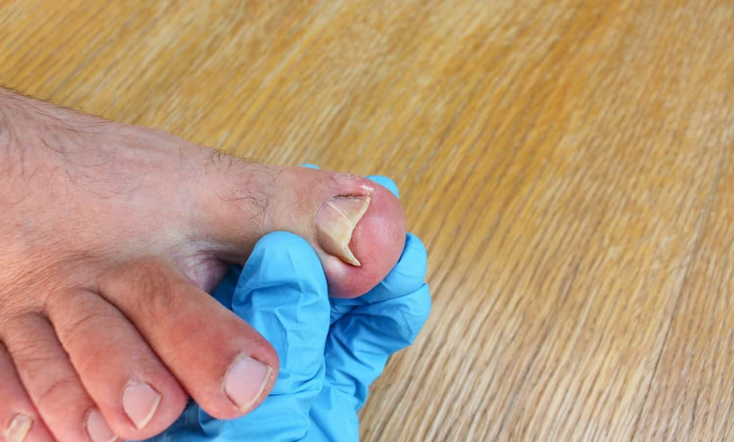 Pie con u&ntilde;as encarnadas sostenida por mano con guante