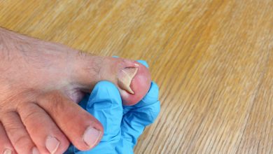 Pie con u&ntilde;as encarnadas sostenida por mano con guante