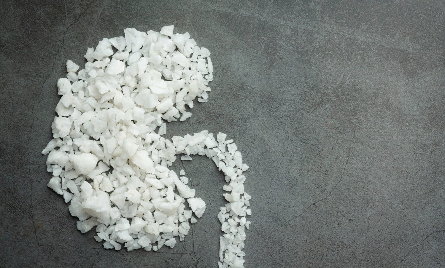 granos grandes de sal formando un ri&ntilde;&oacute;n sobre piso oscuro, como alegor&iacute;a a los c&aacute;lculos renales