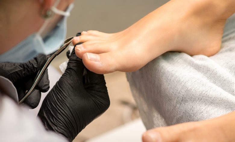 Podólogo limpiando las uñas a una persona, para evitar hongos