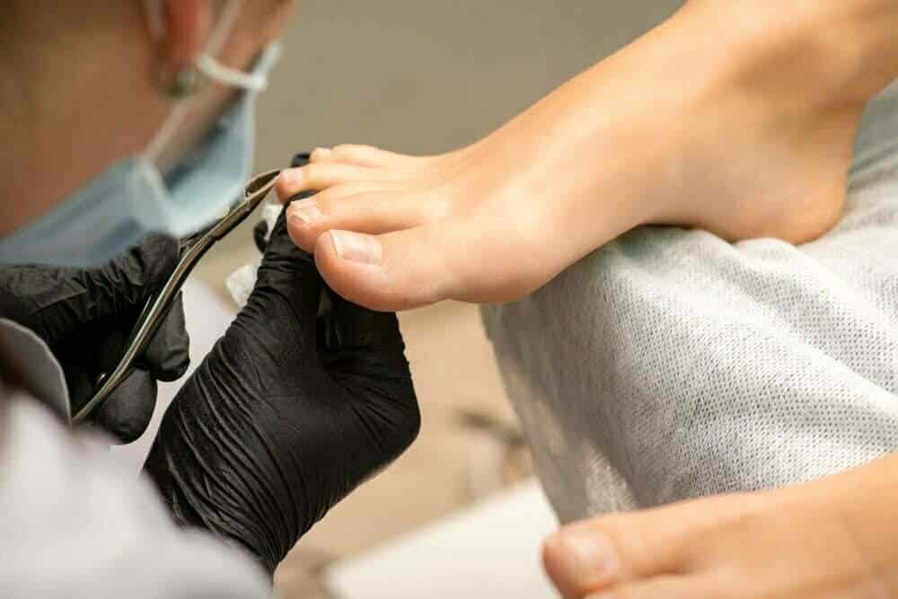 Pod&oacute;logo limpiando las u&ntilde;as a una persona, para evitar hongos