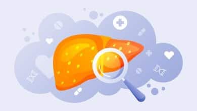 Ilustraci&oacute;n de h&iacute;gado graso degradado