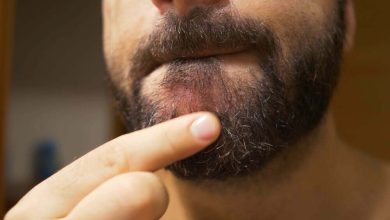 Foliculitis de la barba: as&iacute; se puede prevenir