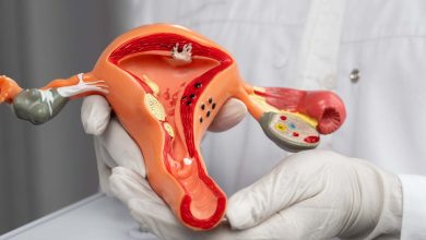 Doctor sosteniendo modelo anat&oacute;mico del sistema reproductor femenino para explicar la endometriosis