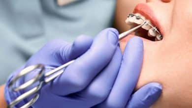 dentista colocando una banda el&aacute;stica de goma sobre los soportes del paciente / ortodoncia