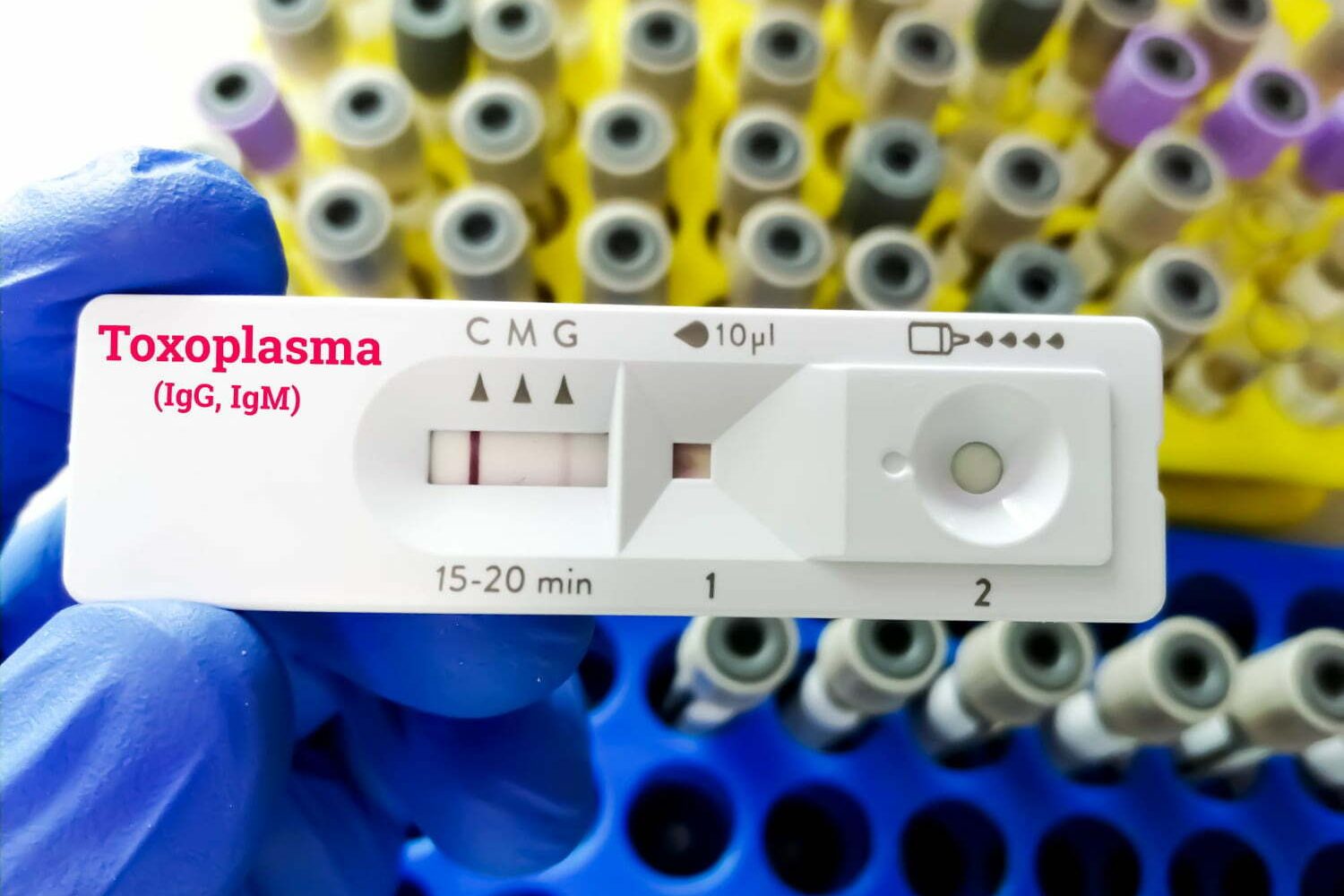 Prueba r&aacute;pida de toxoplasmosis