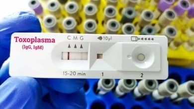 Prueba r&aacute;pida de toxoplasmosis