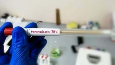 muestra de saliva para la prueba de mononucleosis infecciosa