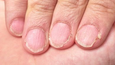 las u&ntilde;as de manos con l&iacute;neas verticales