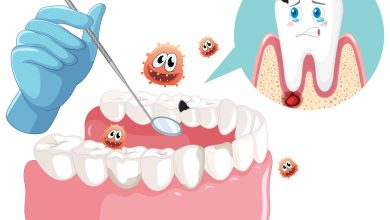 Ilustraci&oacute;n de mano de dentista con modelo de caries de dientes humanos